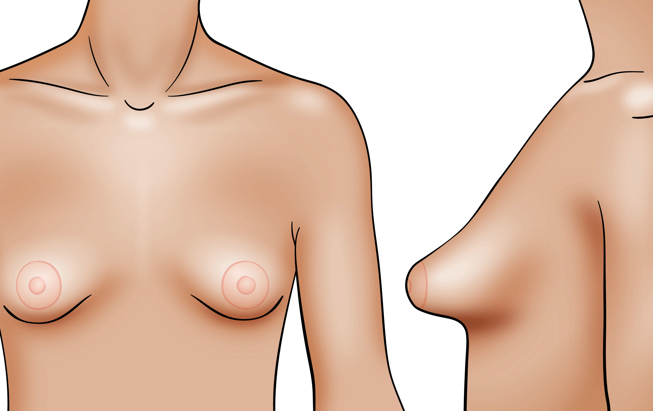 derrick hogan recommends mild big tits bob gass add mild big tits photo