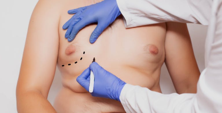 annette chalmers recommends puffy titis christian deyoung add puffy titis photo