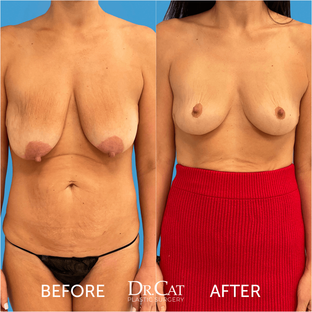 carol stitt recommends Asmr network leaks blaze saddles add nude sagging breasts photo