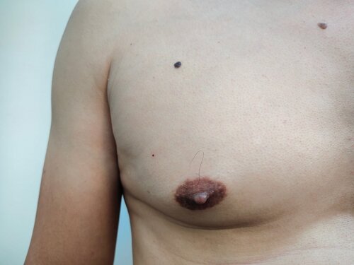 aaron goulding recommends www puffynipples com adel ham add Porn videos hidden cam photo
