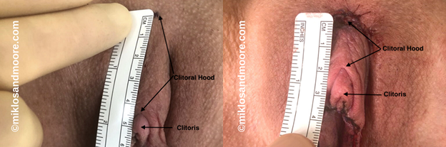azadeh najafi recommends Celebrity srx videos christine perrino add enlarged clit pics photo
