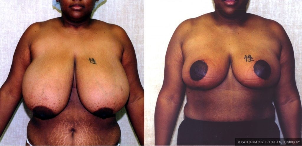 daniel start recommends big black african tits brannon wright add Best swimsuits for sagging breasts photo