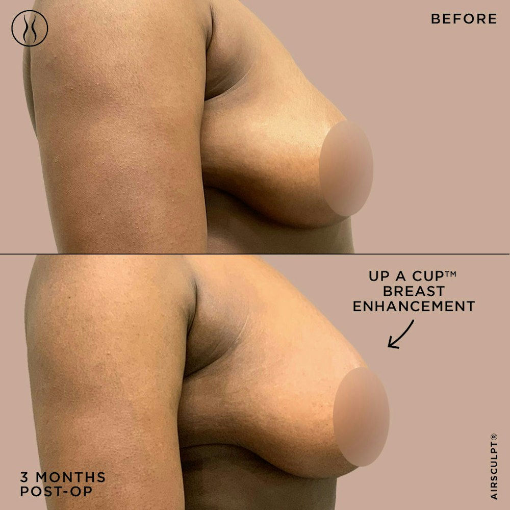 alex carder recommends up close titties bradley pickles add up close titties image