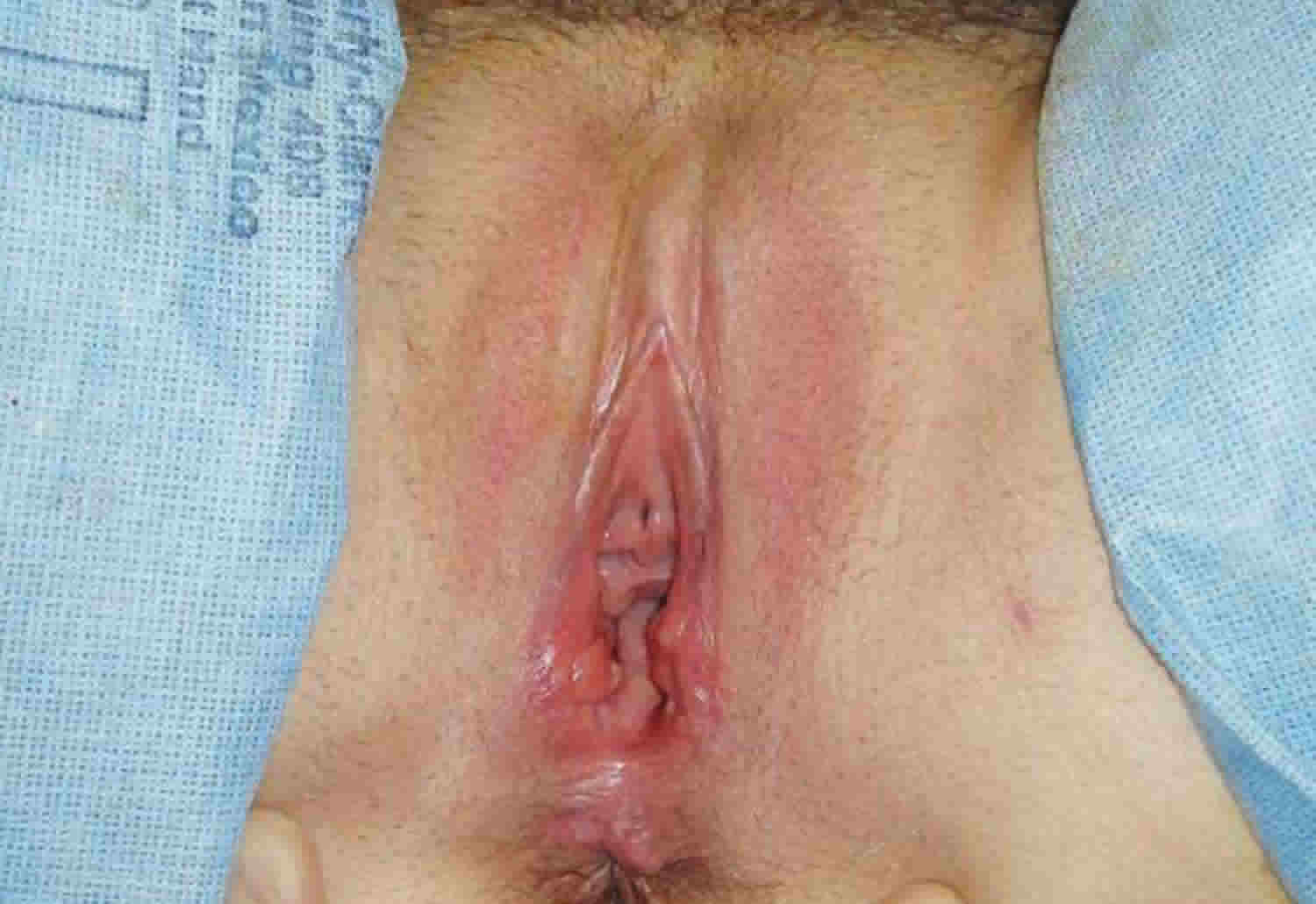 brooke mattox johnson recommends gaping vulva aletha armstrong add gaping vulva photo