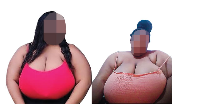 andrew burckhard add nigerian huge tits image