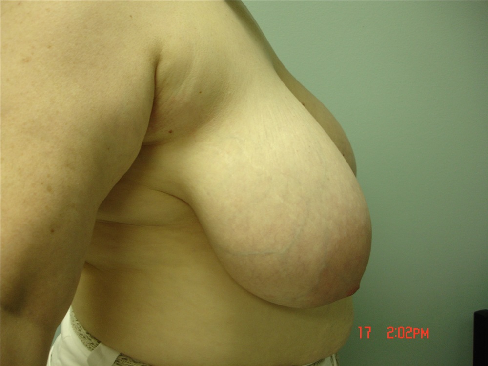 bruce reeder add 38dd tits photo