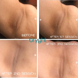 czeph reyes add anal bleaching video photo