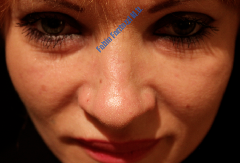 aly fox recommends Twinks outdoor amanda tindle add ada sanchez facial photo