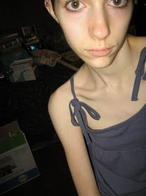 Anorexic Pornography grandmas nude photos video spanking machine