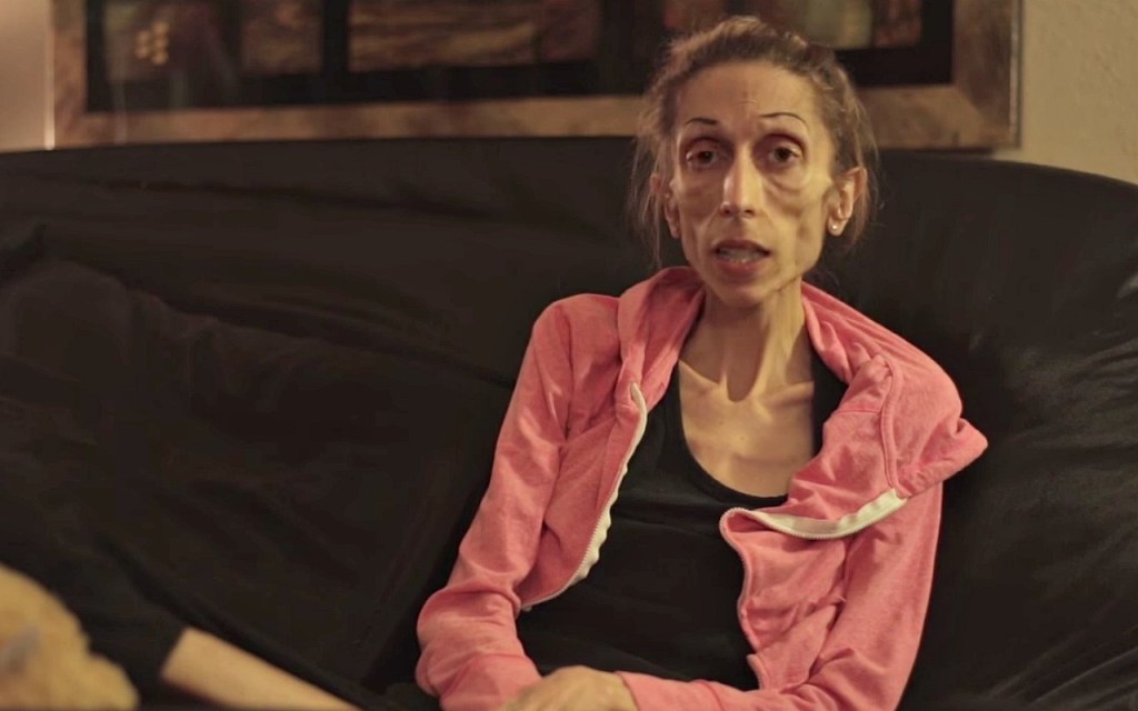 Anorexic Pornography bending over for a spanking nude male physical exam