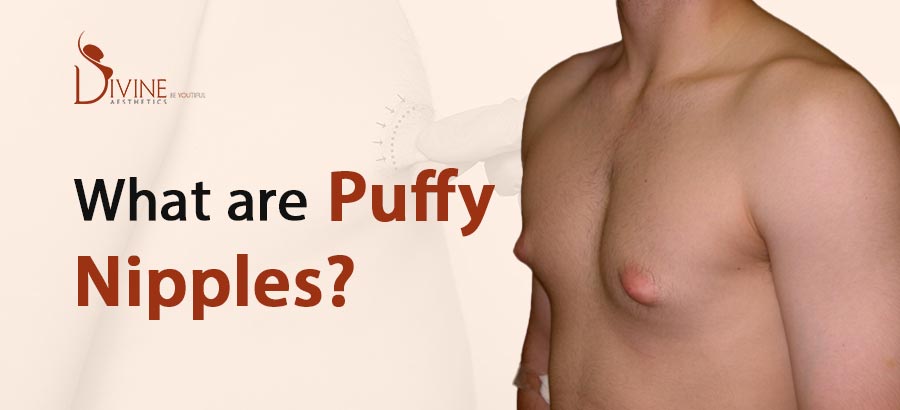 adam azevedo recommends puffy titis bradley moran add puffy titis image
