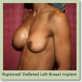 aj chalk recommends big tear drop tits brian contos add big tear drop tits image