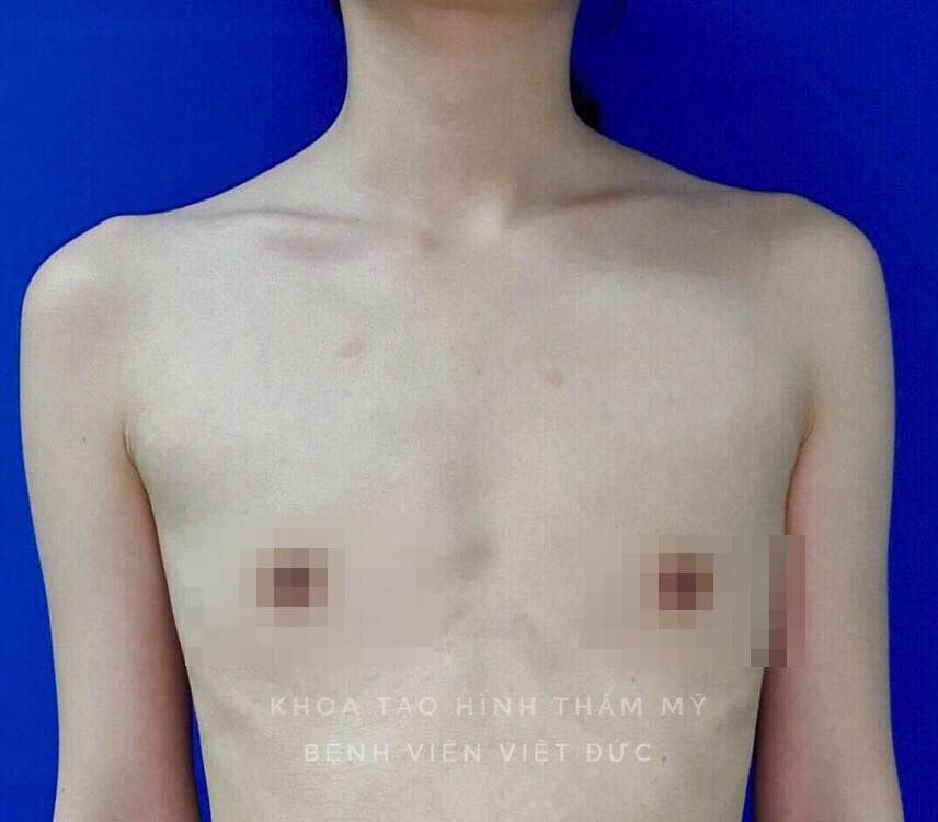 andrew whittenburg add vietnam big tits photo