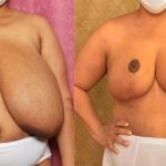 diane matt add giant floppy tits photo