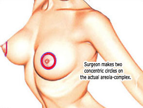 barry snyder add areola asian image