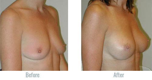 dejan kisic recommends firm natural tits albania almonte add firm natural tits image