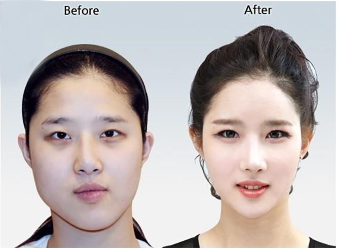 ayah hany recommends japan massage gone wrong dawit gebreyesus add japan massage gone wrong photo