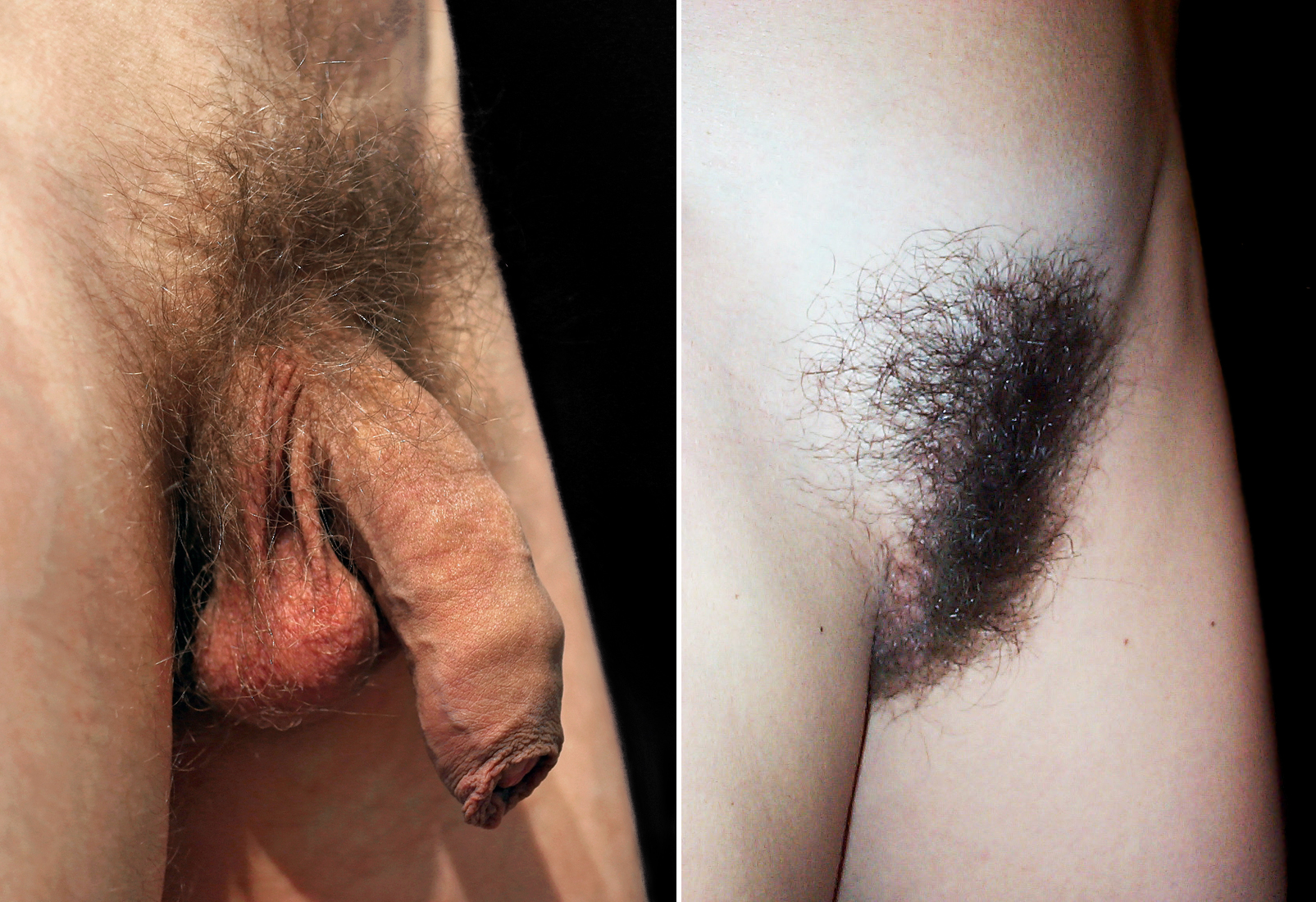 ben mcgahey add naked pubes photo