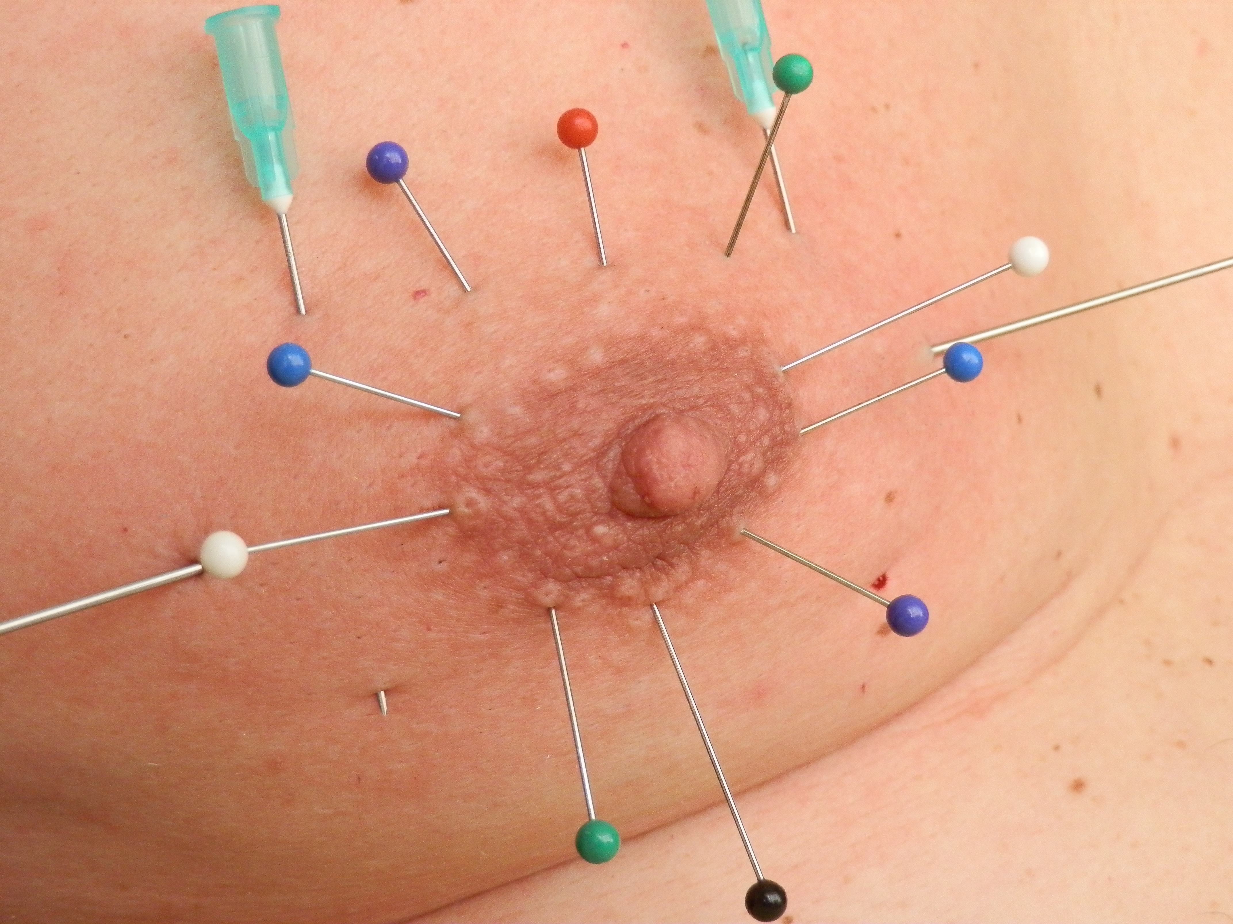 doug frame recommends Pornstar face finder curtis lovett add nipple needle torture photo