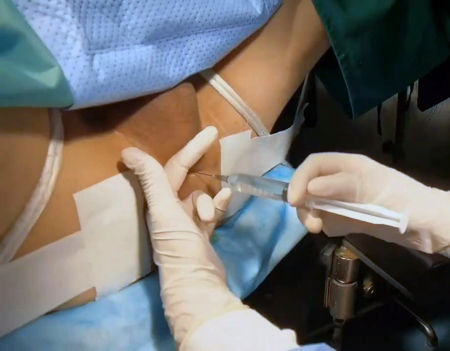agus nst add surgical bdsm image