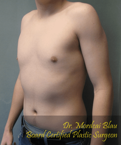darren vance recommends tiny puffy tits daniel hochkircher add tiny puffy tits photo