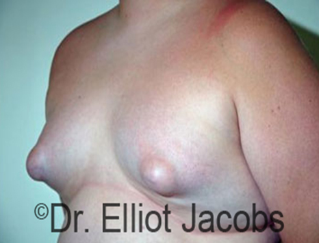 audrey mathis recommends www puffynipples com anthony nnaji add www puffynipples com photo
